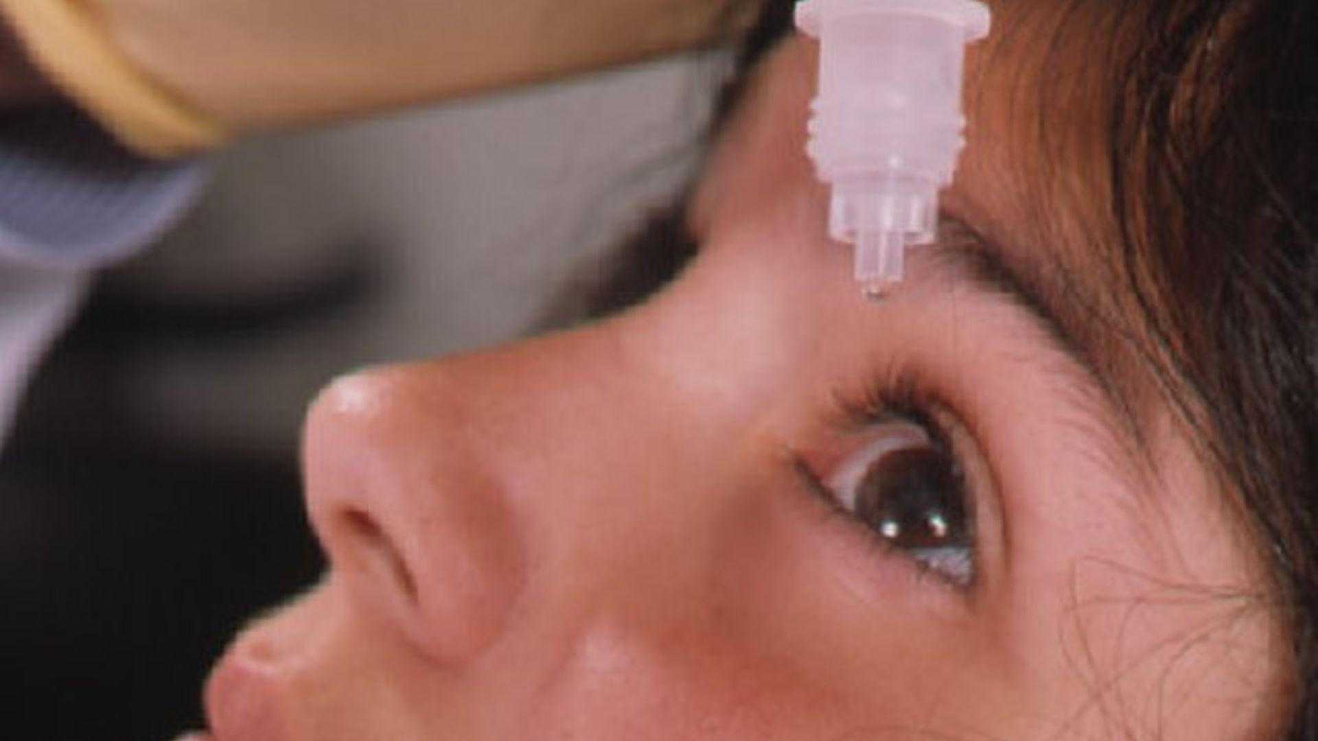 A close-up image of a woman's face as she lies back to receive eye drops from a translucent dropper bottle held directly above her eye